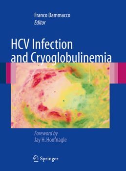 Paperback Hcv Infection and Cryoglobulinemia Book