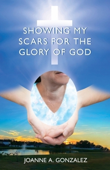 Paperback Showing My Scars for the Glory of God Book
