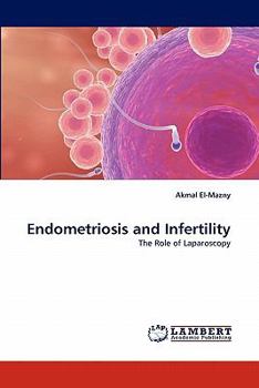 Paperback Endometriosis and Infertility Book