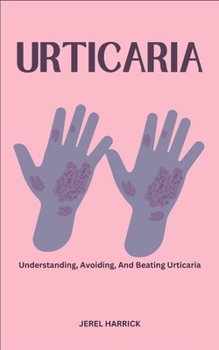 Urticaria: Understanding, Avoiding, And Beating Urticaria