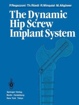 Paperback The Dynamic Hip Screw Implant System Book