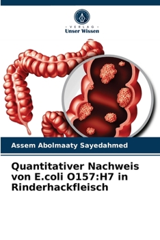 Paperback Quantitativer Nachweis von E.coli O157: H7 in Rinderhackfleisch [German] Book