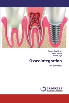 Paperback Osseointegration Book