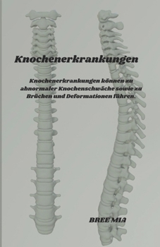 Paperback Knochenerkrankungen: Knochenerkrankungen können zu abnormaler Knochenschwäche sowie zu Brüchen und Deformationen führen. [German] Book