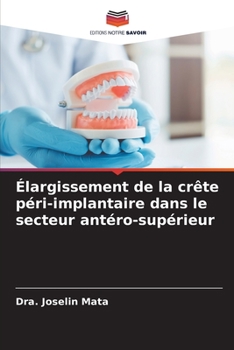 Paperback Élargissement de la crête péri-implantaire dans le secteur antéro-supérieur [French] Book
