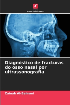 Diagnóstico de fracturas do osso nasal por ultrassonografia (Portuguese Edition)