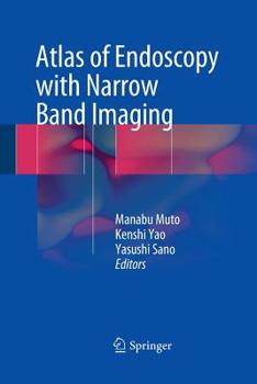 Paperback Atlas of Endoscopy with Narrow Band Imaging Book