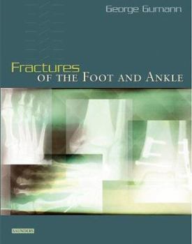 Hardcover Fractures of the Foot and Ankle Book