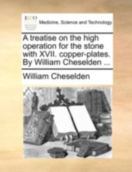 Paperback A treatise on the high operation for the stone with XVII. copper-plates. By William Cheselden ... Book