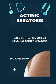 Paperback Actinic Keratosis: Different Techniques for Handling Actinic Keratosis Book