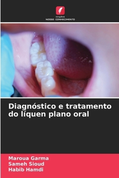 Paperback Diagnóstico e tratamento do líquen plano oral [Portuguese] Book