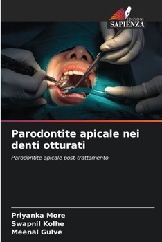 Paperback Parodontite apicale nei denti otturati [Italian] Book