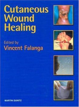 Hardcover Cutaneous Wound Healing Book