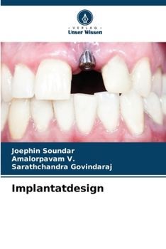 Paperback Implantatdesign [German] Book