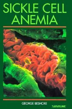 Hardcover Sickle Cell Anemia Book