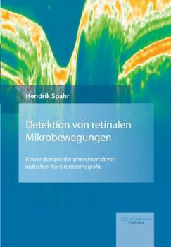 Paperback Detektion von retinalen Mikrobewegungen [German] Book