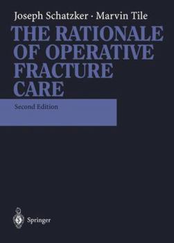 The Rationale of Operative Fracture Care