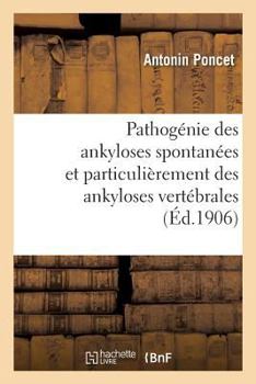Paperback Pathogénie Des Ankyloses Spontanées Et Particulièrement Des Ankyloses Vertébrales [French] Book