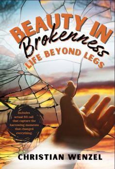 Beauty in Brokenness: Life Beyond Legs