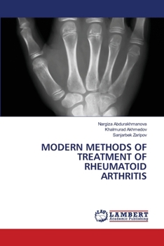 Modern Methods of Treatment of Rheumatoid Arthritis