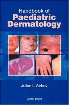 Paperback Handbook of Paediatric Dermatology Book