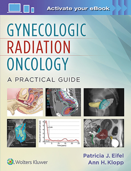 Hardcover Gynecologic Radiation Oncology: A Practical Guide Book