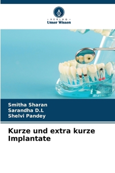 Paperback Kurze und extra kurze Implantate [German] Book