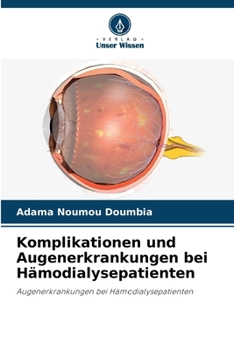 Komplikationen und Augenerkrankungen bei Hämodialysepatienten (German Edition)