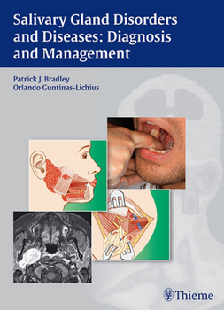 Hardcover Salivary Gland Disorders and Diseases:: Diagnosis and Management Book