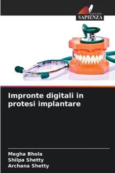 Paperback Impronte digitali in protesi implantare [Italian] Book
