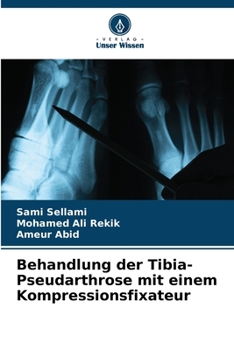 Paperback Behandlung der Tibia-Pseudarthrose mit einem Kompressionsfixateur [German] Book