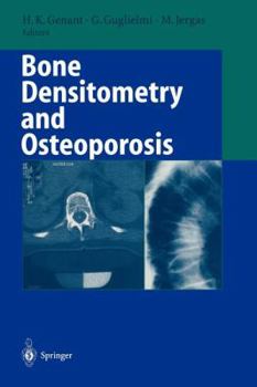 Paperback Bone Densitometry and Osteoporosis Book