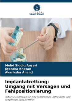 Implantatrettung: Umgang mit Versagen und Fehlpositionierung (German Edition)