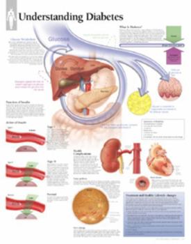 Misc. Understanding Diabetes Chart: Laminated Wall Chart Book