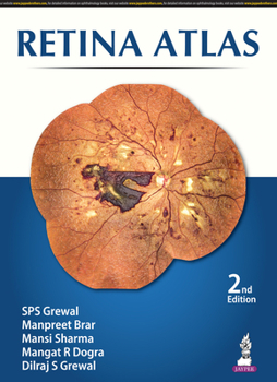 Hardcover Retina Atlas Book