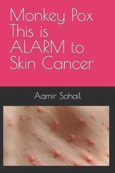 Paperback Monkey Pox This is ALARM to Skin Cancer Book