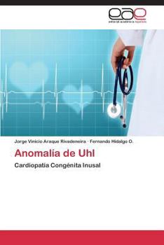 Paperback Anomalía de Uhl [Spanish] Book