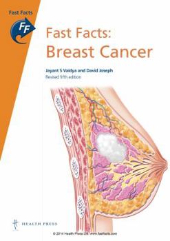 Paperback Fast Facts: Breast Cancer Book