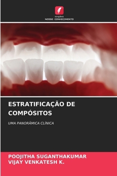 ESTRATIFICAÇÃO DE COMPÓSITOS: UMA PANORÂMICA CLÍNICA (Portuguese Edition)