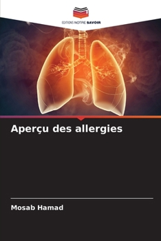 Paperback Aperçu des allergies [French] Book