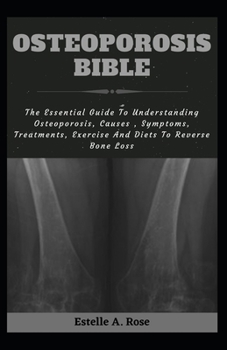 Paperback Osteoporosis Bible: The Essential Guide To Understanding Osteoporosis, Causes, Symptoms, Treatments, Exercise And Diets To Reverse Bone Lo Book
