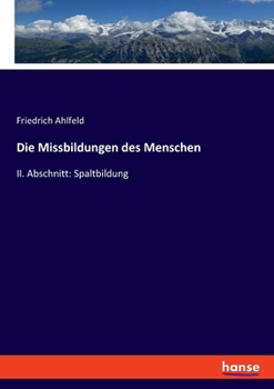 Paperback Die Missbildungen des Menschen: II. Abschnitt: Spaltbildung [German] Book