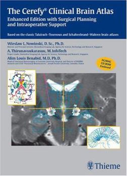 CD-ROM The Cerefy Clinical Brain Atlas/CD-ROM: Enhanced Edition with Surgical Planning and Intraoperative Support Book