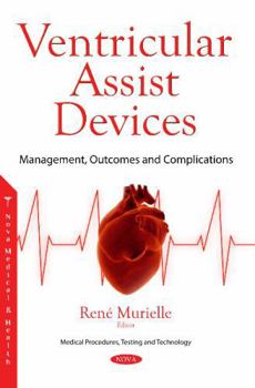 Paperback Ventricular Assist Devices: Management, Outcomes and Complications Book