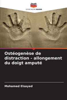 Paperback Ostéogenèse de distraction - allongement du doigt amputé [French] Book