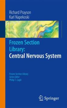 Paperback Frozen Section Library: Central Nervous System Book