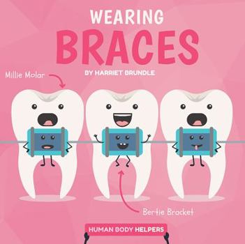 Wearing Braces