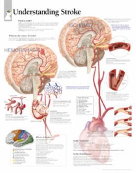 Wall Chart Understanding Stroke Chart: Laminated Wall Chart Book