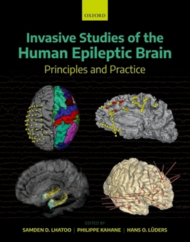 Hardcover Invasive Studies of the Human Epileptic Brain: Principles and Practice Book