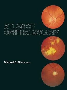 Paperback Atlas of Ophthalmology Book